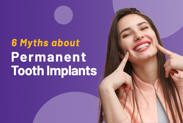 6 Myths about Permanent Tooth Replacement