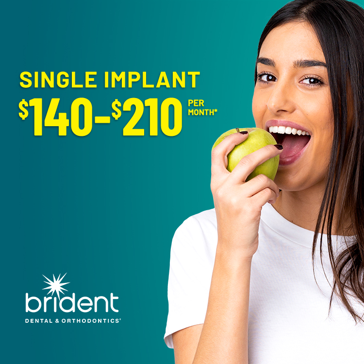 Implante único: $140-210 al mes*